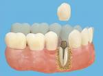 Прайс-лист гранд елизавета, стоматологічна клініка