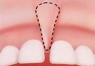 Лечение зубов в балашихе