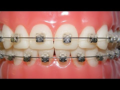 Лечение зубов в солнцево цены